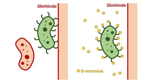 Billedet viser to bakterier, en uden pili og en med pili. Man kan se, at bakterien med pili hæfter sig fast på overfladen af blæren, i det såkaldte epithelcellelag