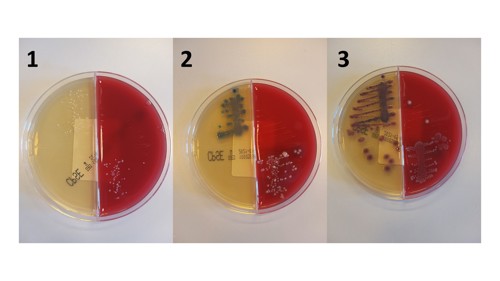 Billede som viser bakterier på en plade